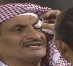 صورة – كيال لا يعرف مصدر “الضربة” التى تلقاها فى العين