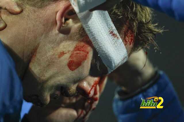 Zenit St Petersburg's Hubocan receives medical aid after he crashed with Borussia Dortmund's Lewandowski during their Champions League round of 16 second leg soccer match in Dortmund