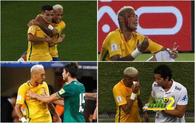 صورة : إصابة نيمار التي جعلته ينزف الدماء بمباراة البرازيل و بوليفيا !