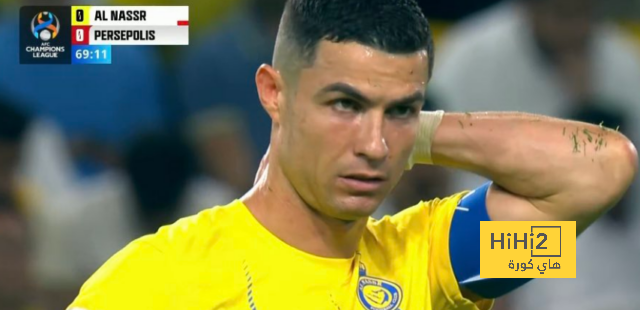 هل يغيب رونالدو عن الديربي بعد إصابته مع النصر؟