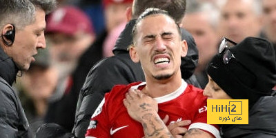 كلوب يتحدث عن سوء إصابة تسميكاس
