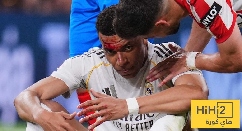 صور – العنف يتكرر ضد ريال مدريد دائمًا بلا حساب!